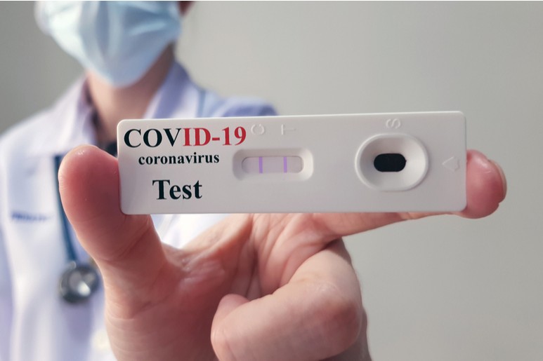 Test de antgenos coronavricos, para el diagnóstico de la infección por el SARS-CoV-2.